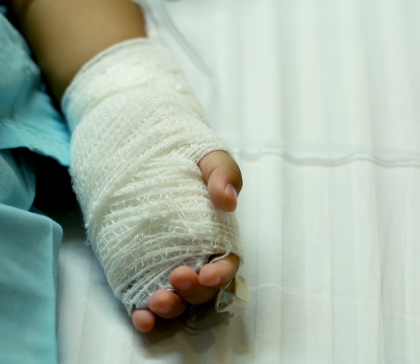 Et barn der er kommet til skade med hånden 